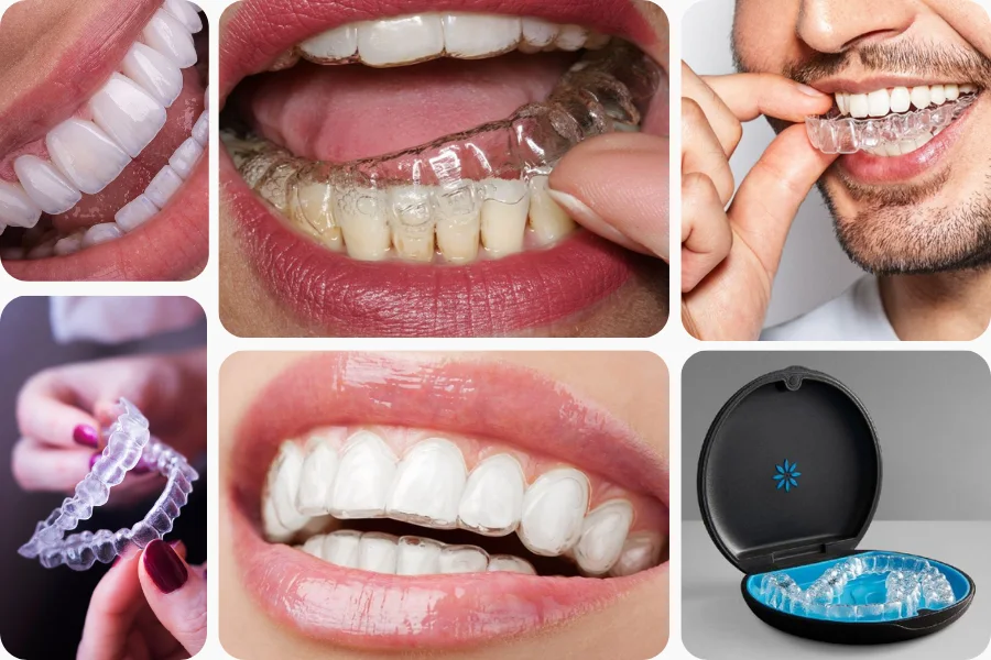 Invisalign Clear Aligners