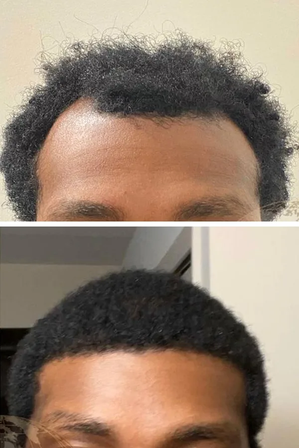 Aslı Tarcan Clinic case