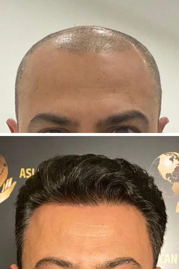 Aslı Tarcan Clinic case