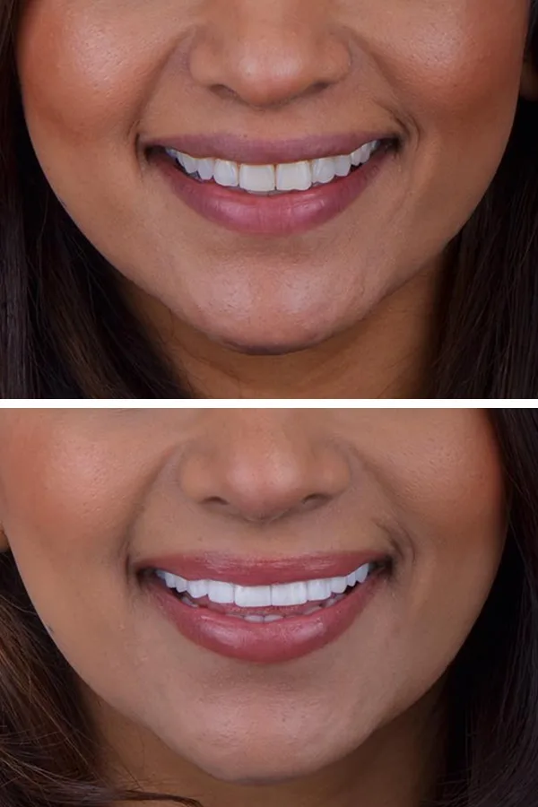 Aslı Tarcan Clinic case