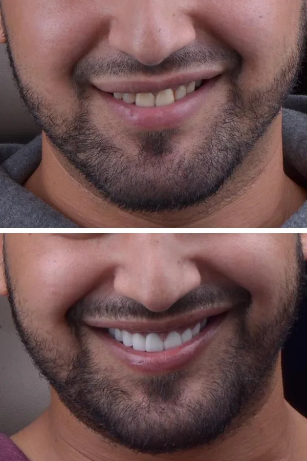 Aslı Tarcan Clinic case