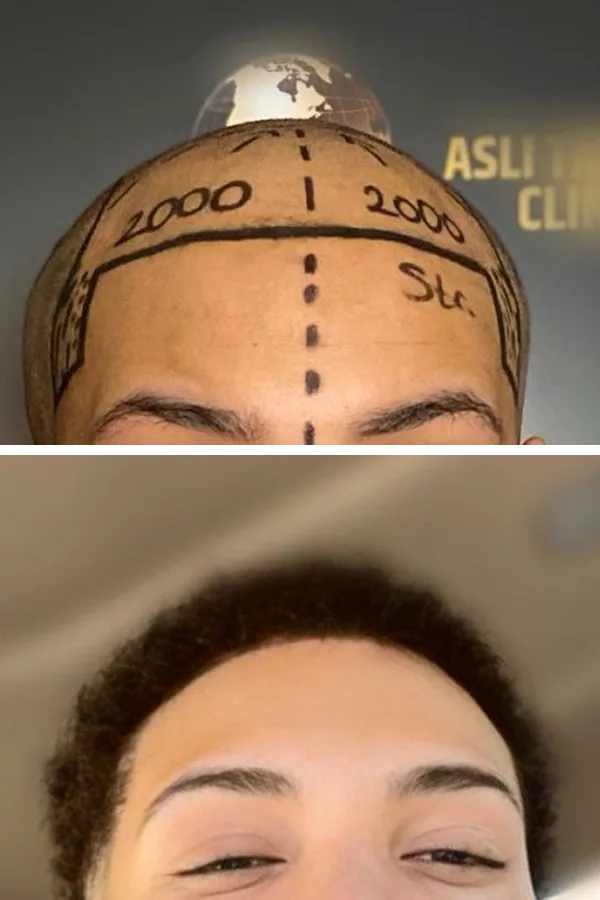 Aslı Tarcan Clinic case