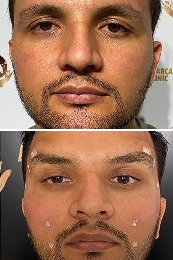 Aslı Tarcan Clinic case