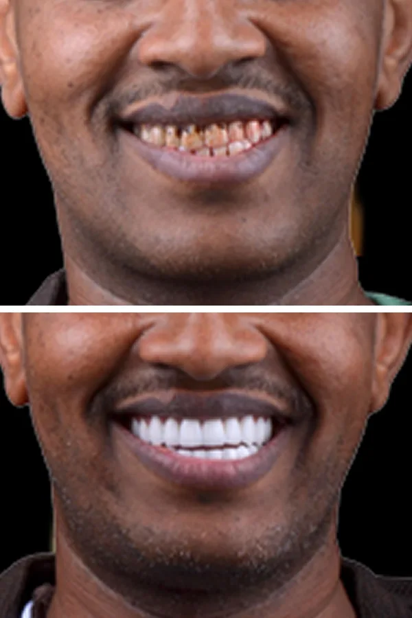 Aslı Tarcan Clinic case