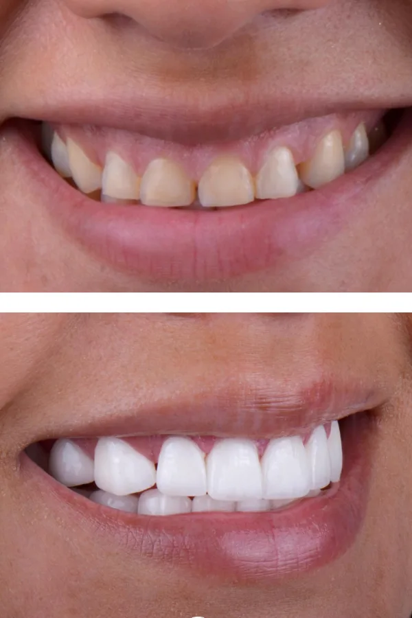 Aslı Tarcan Clinic case