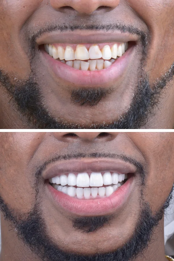 Aslı Tarcan Clinic case