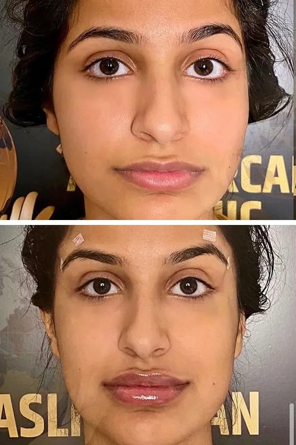 Aslı Tarcan Clinic case