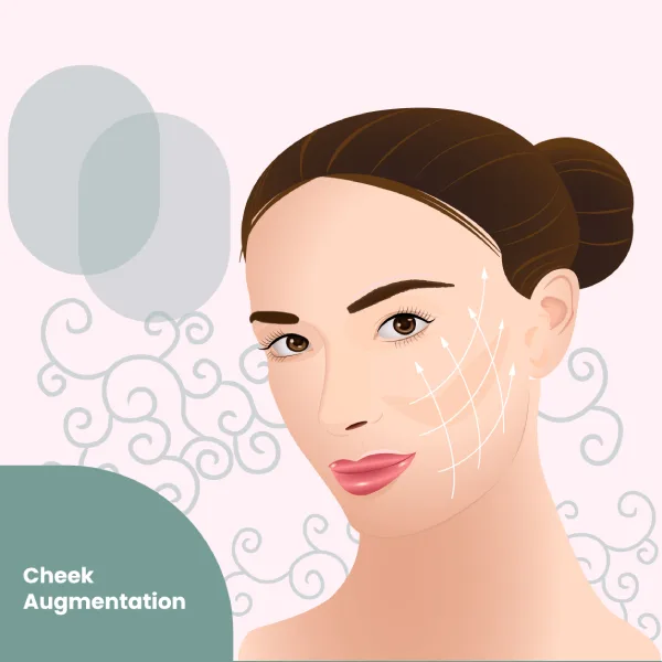 Cheek Augmentation
