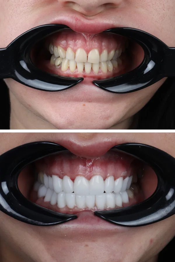 Dentica International case