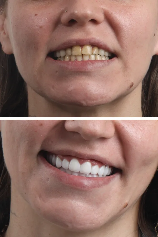 Dentica International case