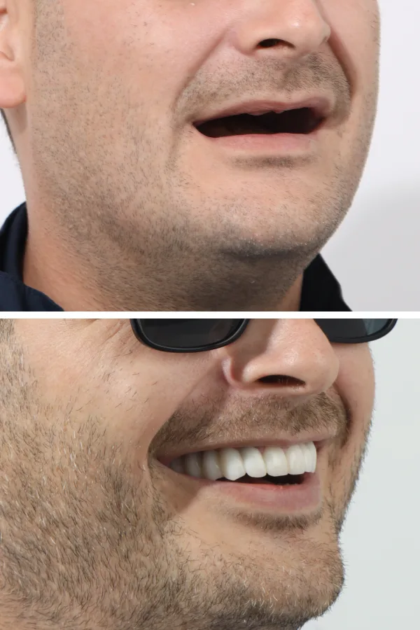 Dentica International case