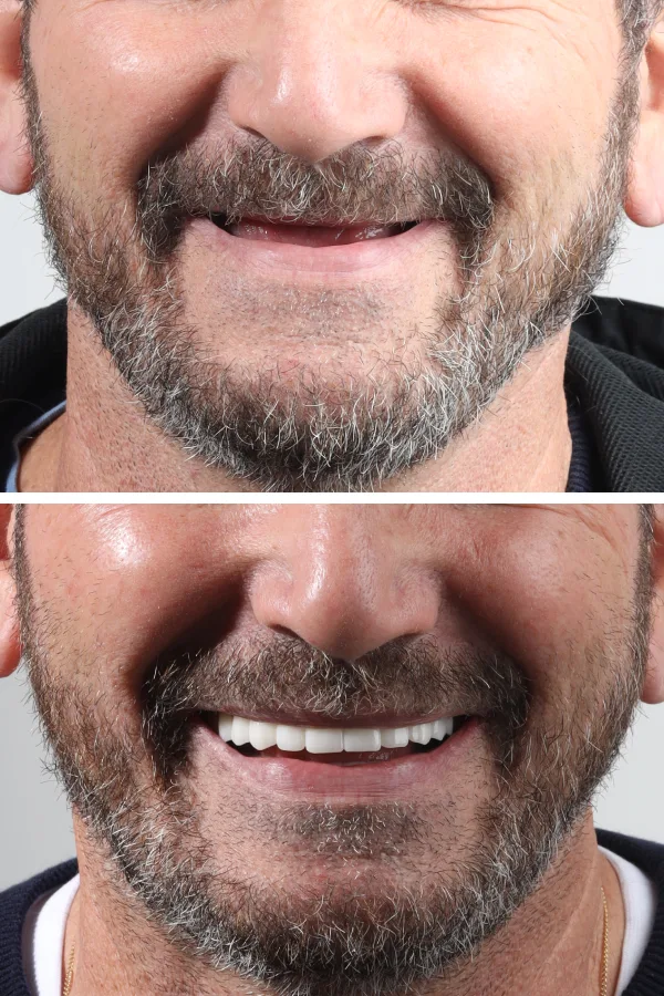 Dentica International case