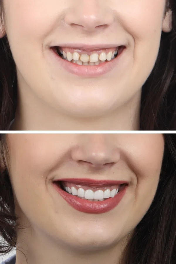 Dentica International case