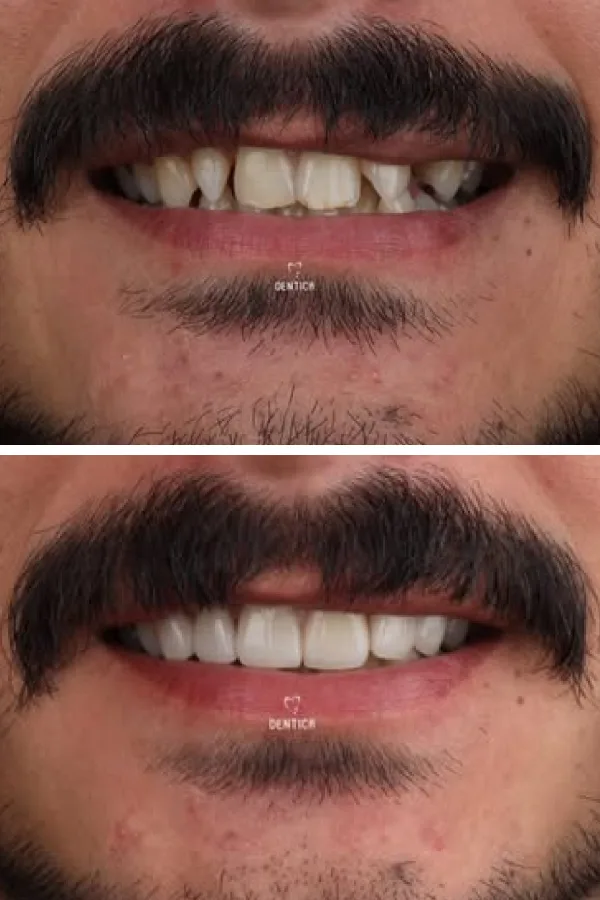 Dentica International case