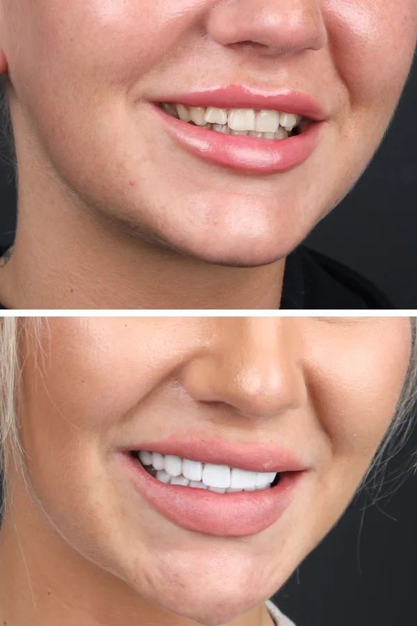 Dentica International case