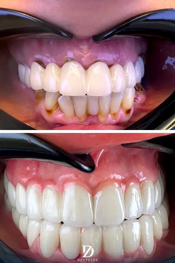 Dentzade Clinic case