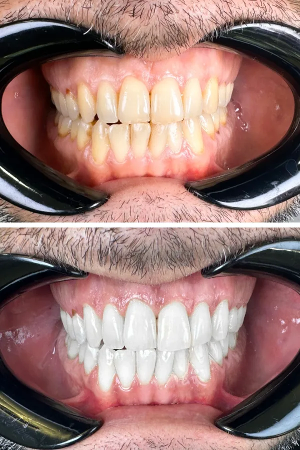 Dentzade Clinic case