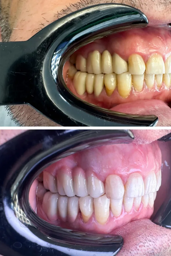 Dentzade Clinic case