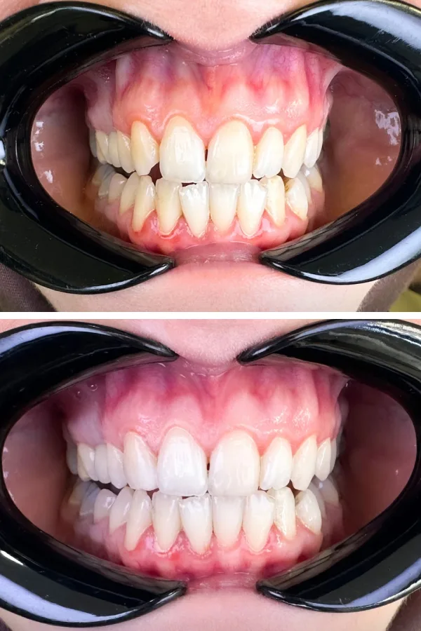 Dentzade Clinic case