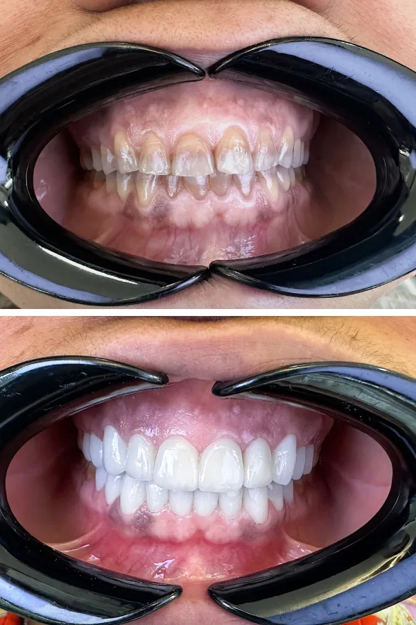 Dentzade Clinic case