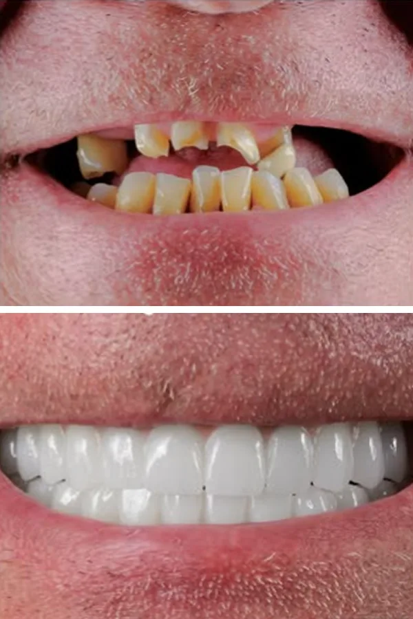 Egedent Clinic — case