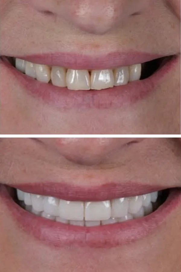 Egedent Clinic — case