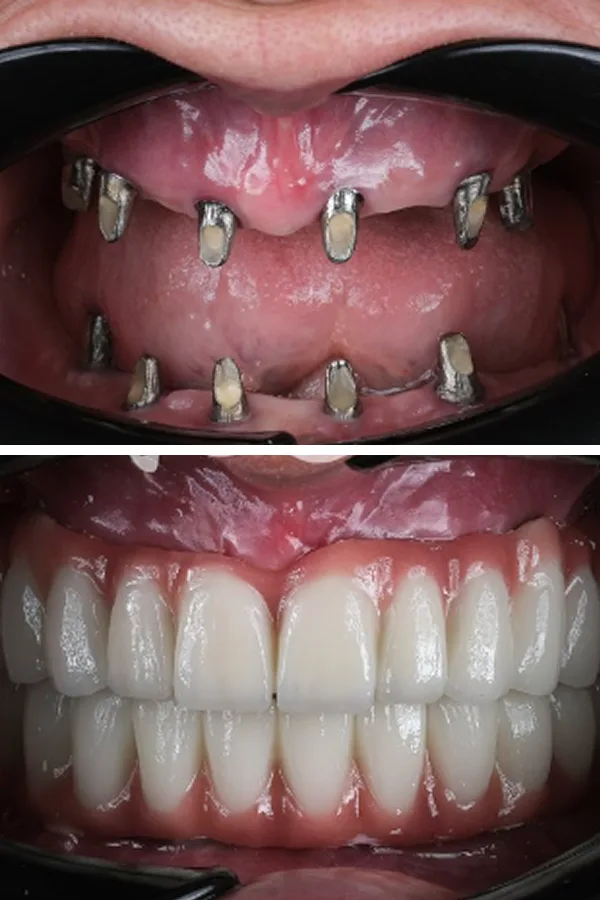 Egedent Clinic — case