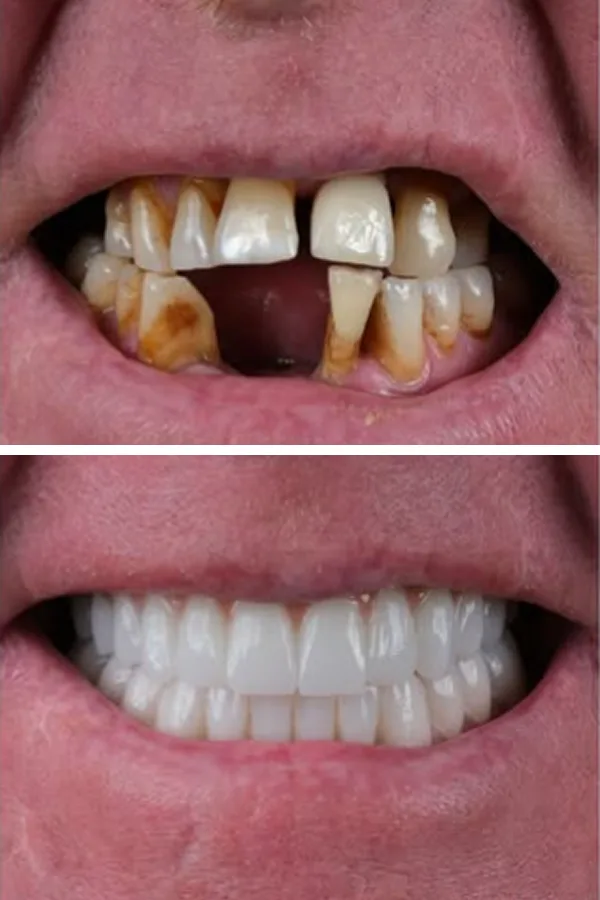 Egedent Clinic — case