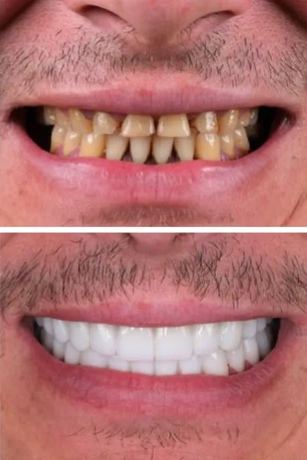 Egedent Clinic — case