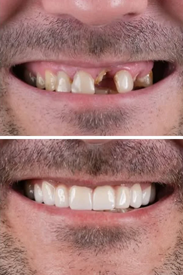 Egedent Clinic — case