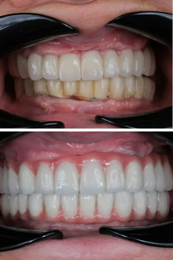 Egedent Clinic — case