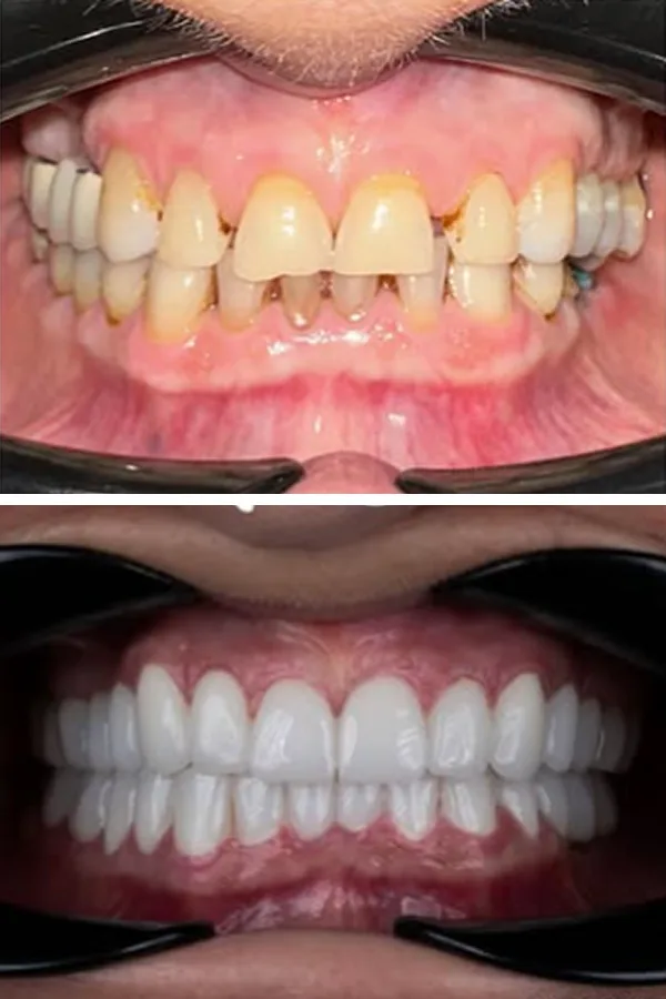 Egedent Clinic — case