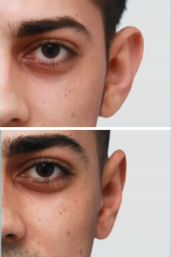 Estetik International case