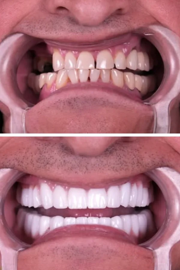 Estherian Dental Clinic case