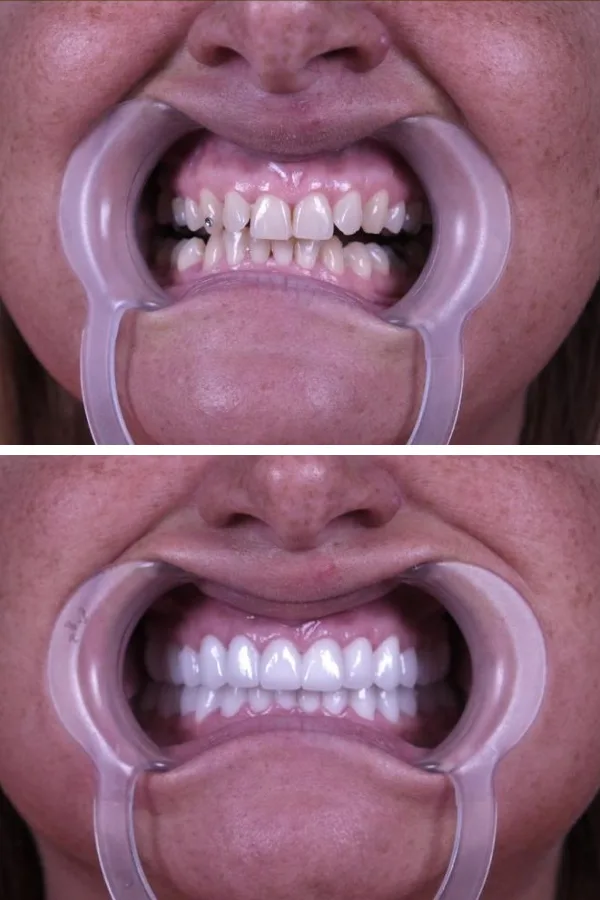 Estherian Dental Clinic case