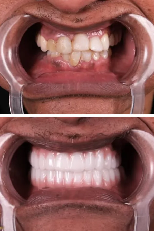Estherian Dental Clinic case
