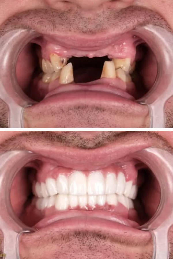 Estherian Dental Clinic case