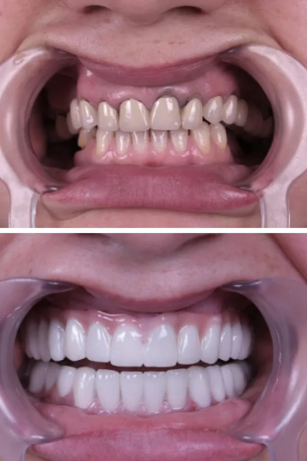 Estherian Dental Clinic case