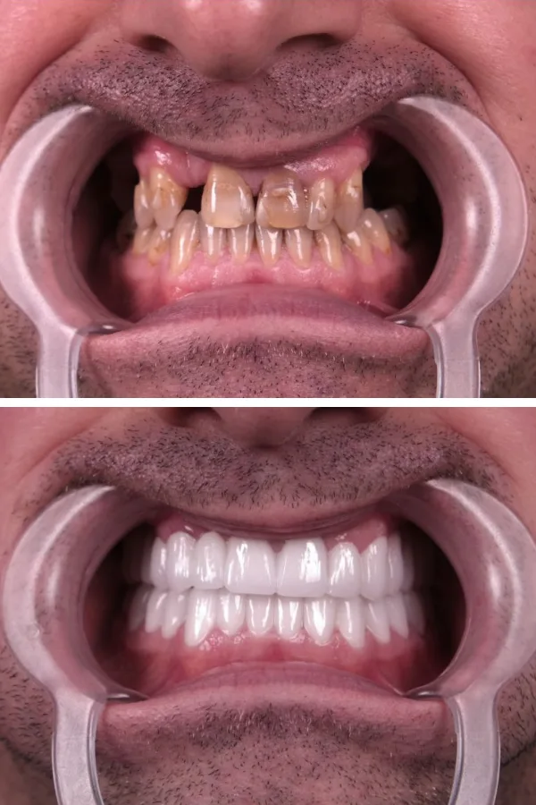 Estherian Dental Clinic case