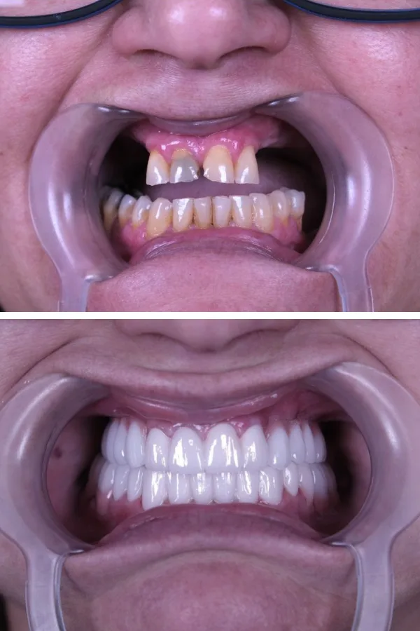 Estherian Dental Clinic case