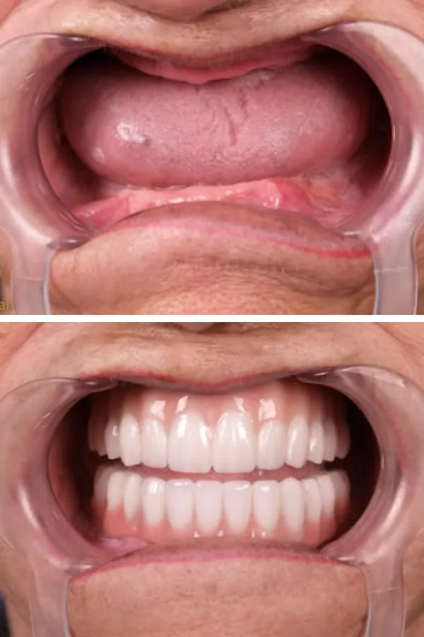 Estherian Dental Clinic case