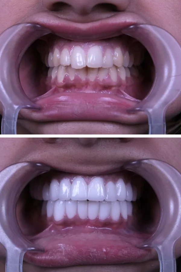 Estherian Dental Clinic case