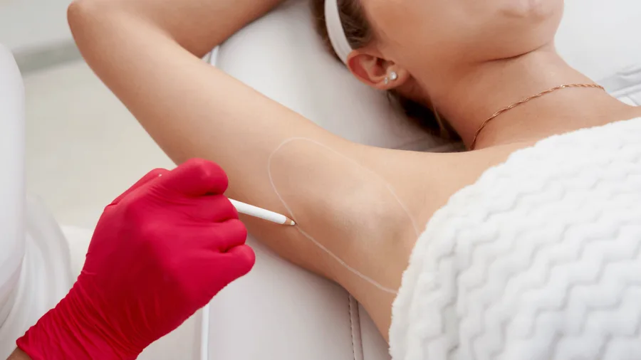 علاج فرط التعرق (التعرق المفرط): ابق جافا، وابق واثقا page background