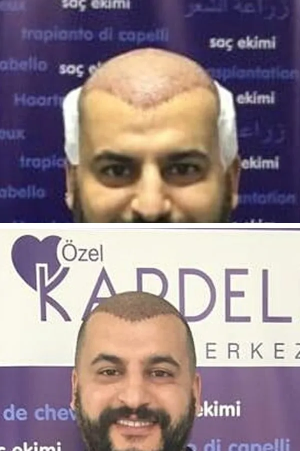 Kardelen Clinic case