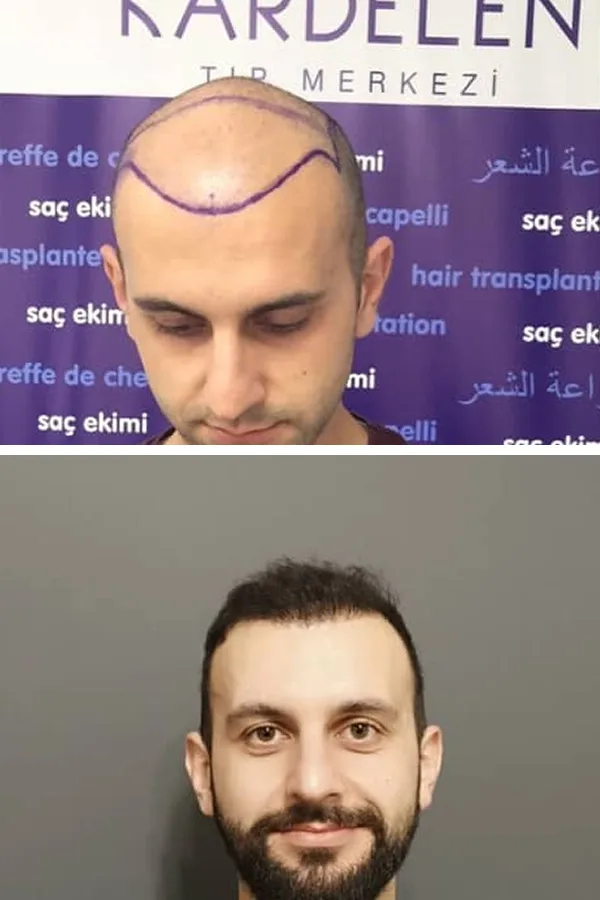 Kardelen Clinic case