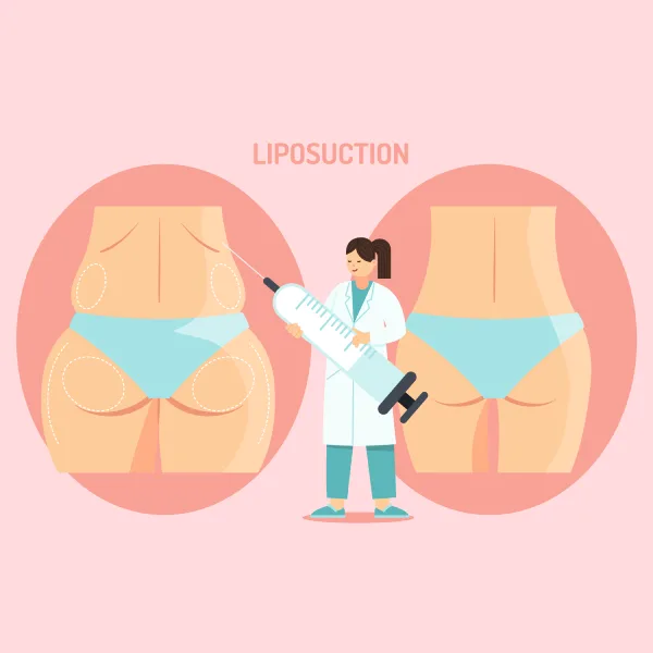 Liposuction