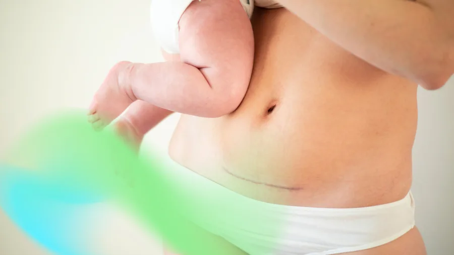 تجديد شامل لقوام الأم: استعدي إشراقتك من جديد page background