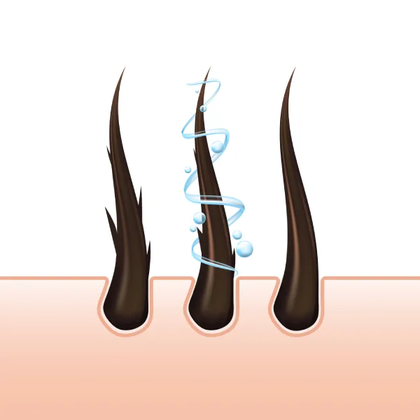 No-Shave Hair Transplantation
