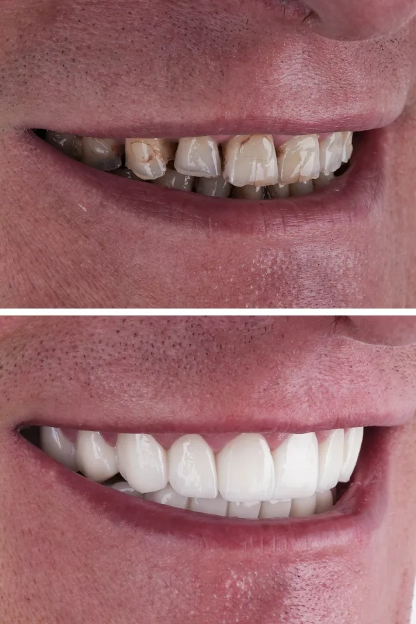 Ömer İstanbul case