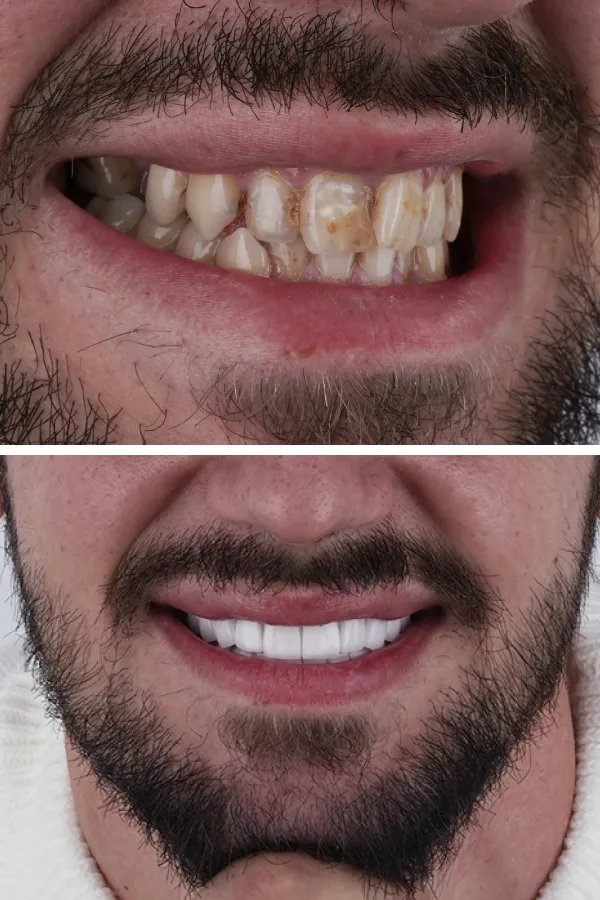 Ömer İstanbul case